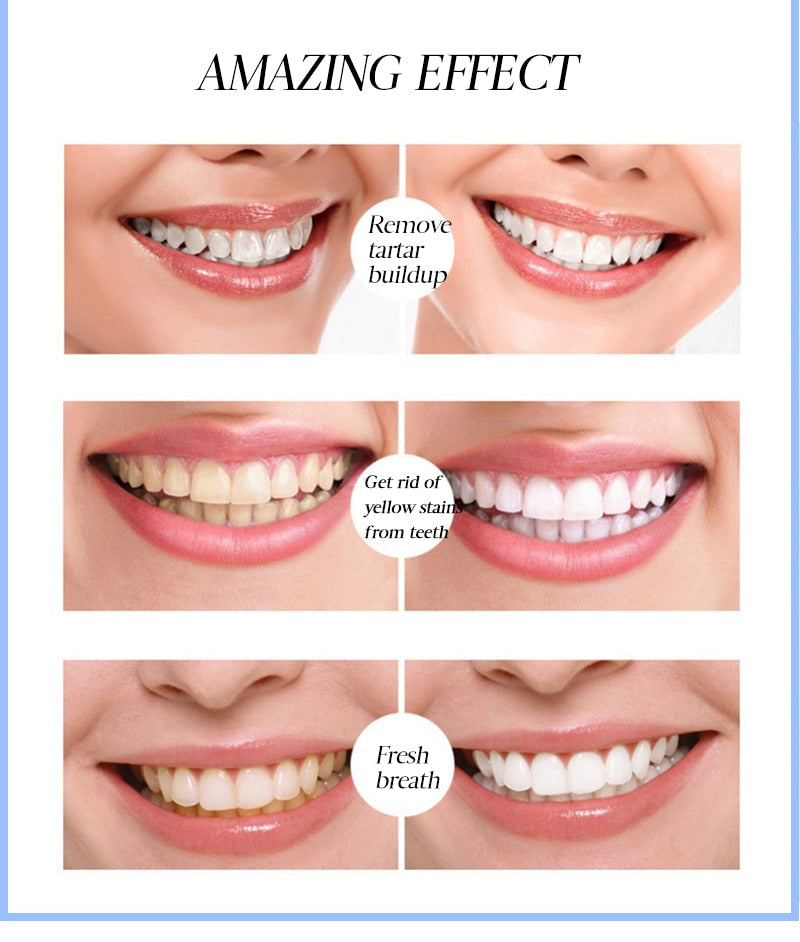 BrightSmilez™ Penna per sbiancamento dei denti