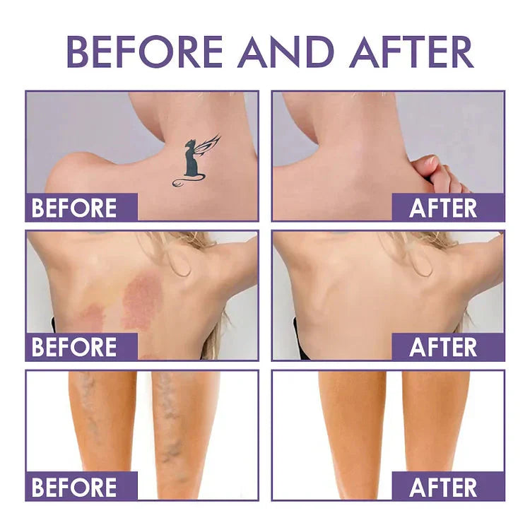 CoverSkin™ Correttore coprente per il corpo