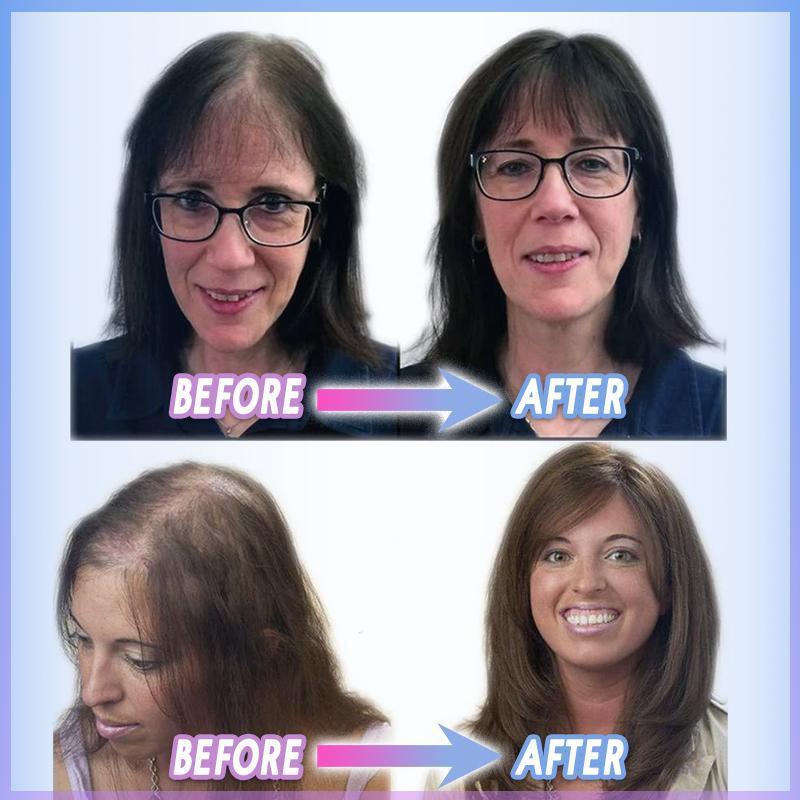 CrownLift™️ Capelli corti fini per le donne