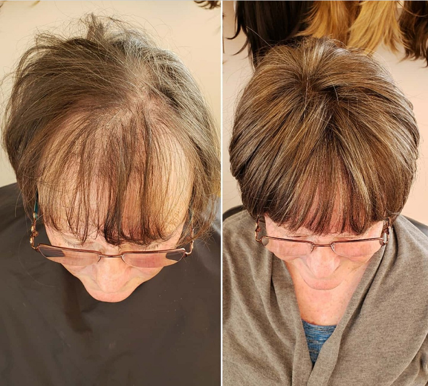 CrownLift™️ Capelli corti fini per le donne