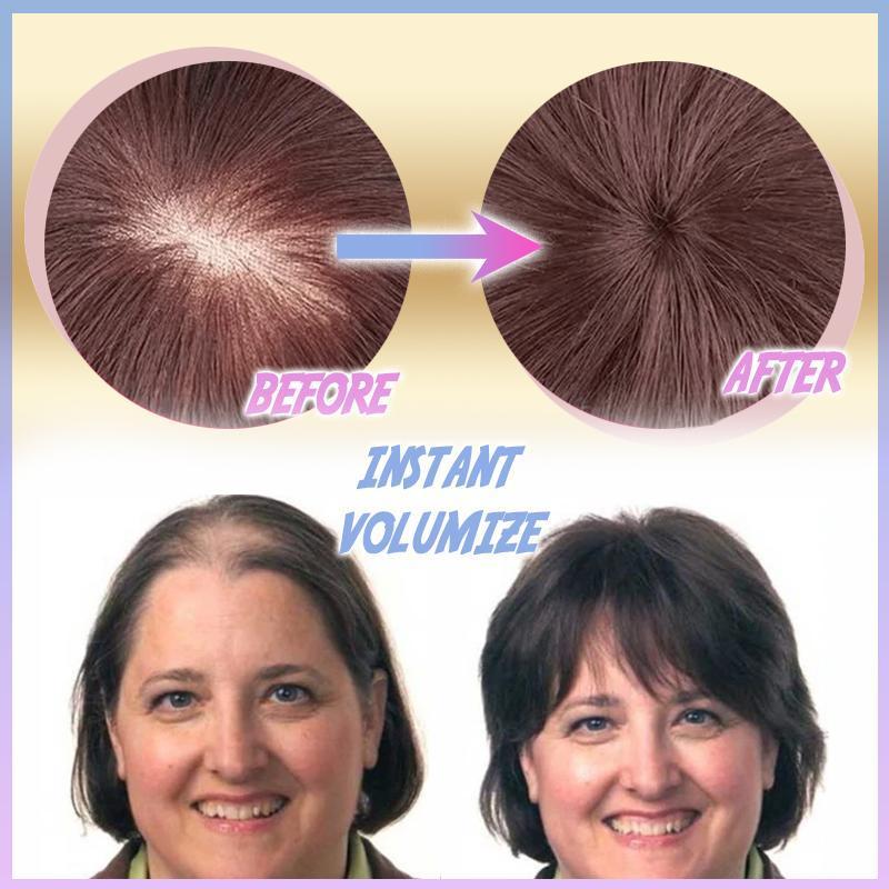CrownLift™️ Capelli corti fini per le donne