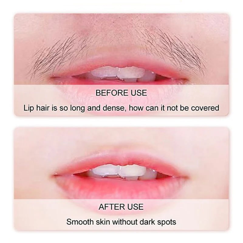 Dermade™ Crema depilatoria per il viso delicata e indolore