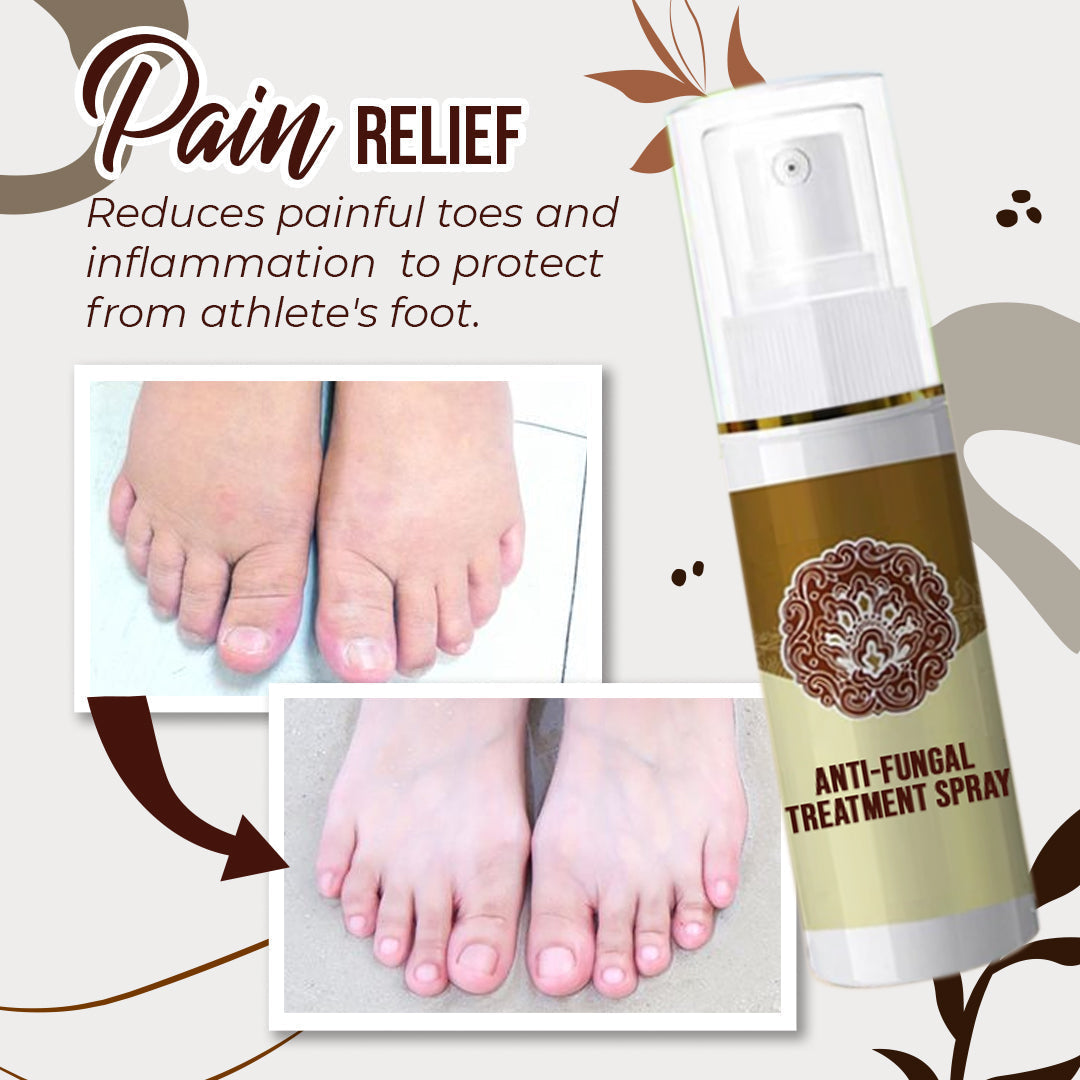 Herbcure™ Spray antifungino