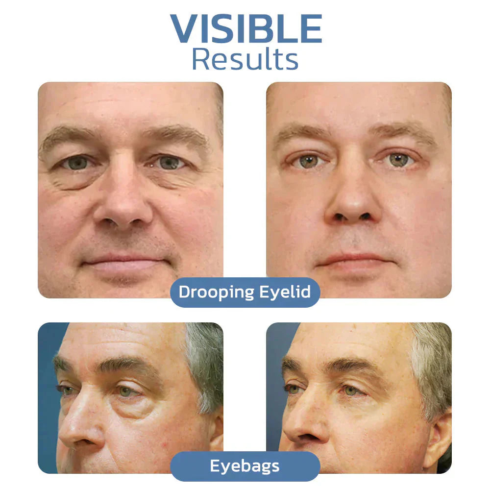 Himse OpenEyes™️ Gel peptidico per il ringiovanimento e il sollevamento della pelle del contorno occhi