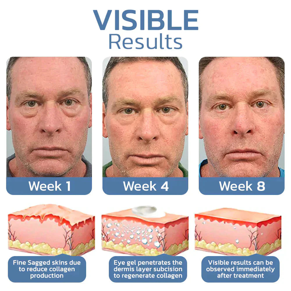 Himse OpenEyes™️ Gel peptidico per il ringiovanimento e il sollevamento della pelle del contorno occhi