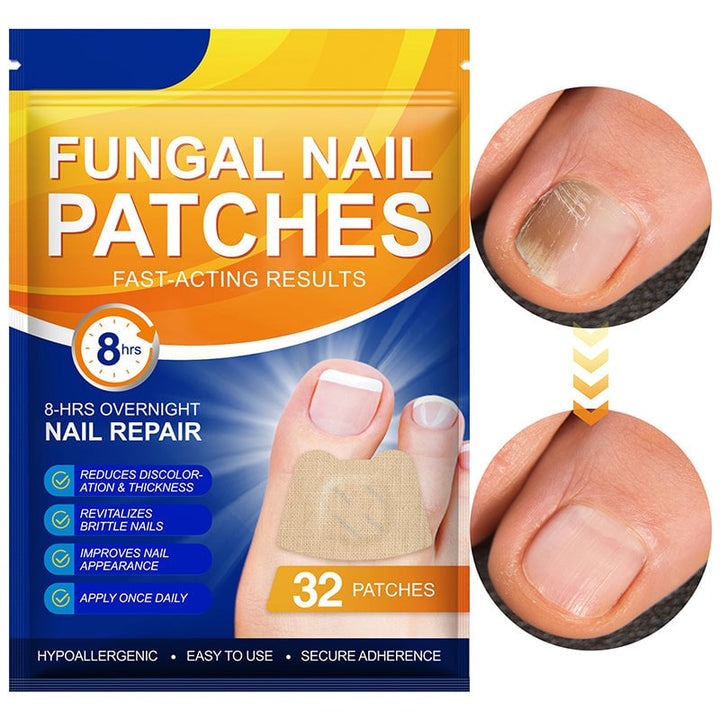 NailNex™ Trattamento efficace per i funghi delle unghie