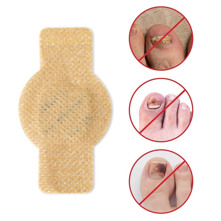 NailNex™ Trattamento efficace per i funghi delle unghie