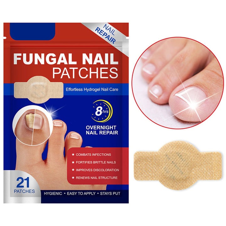 NailNex™ Trattamento efficace per i funghi delle unghie