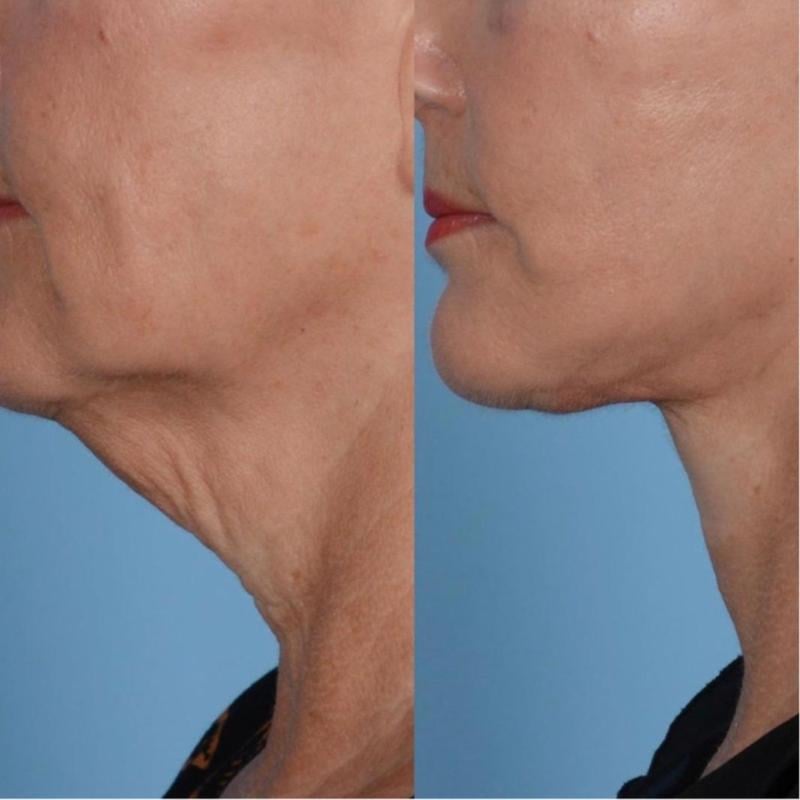 Samuwac™ Crema nutriente per il collo in stick