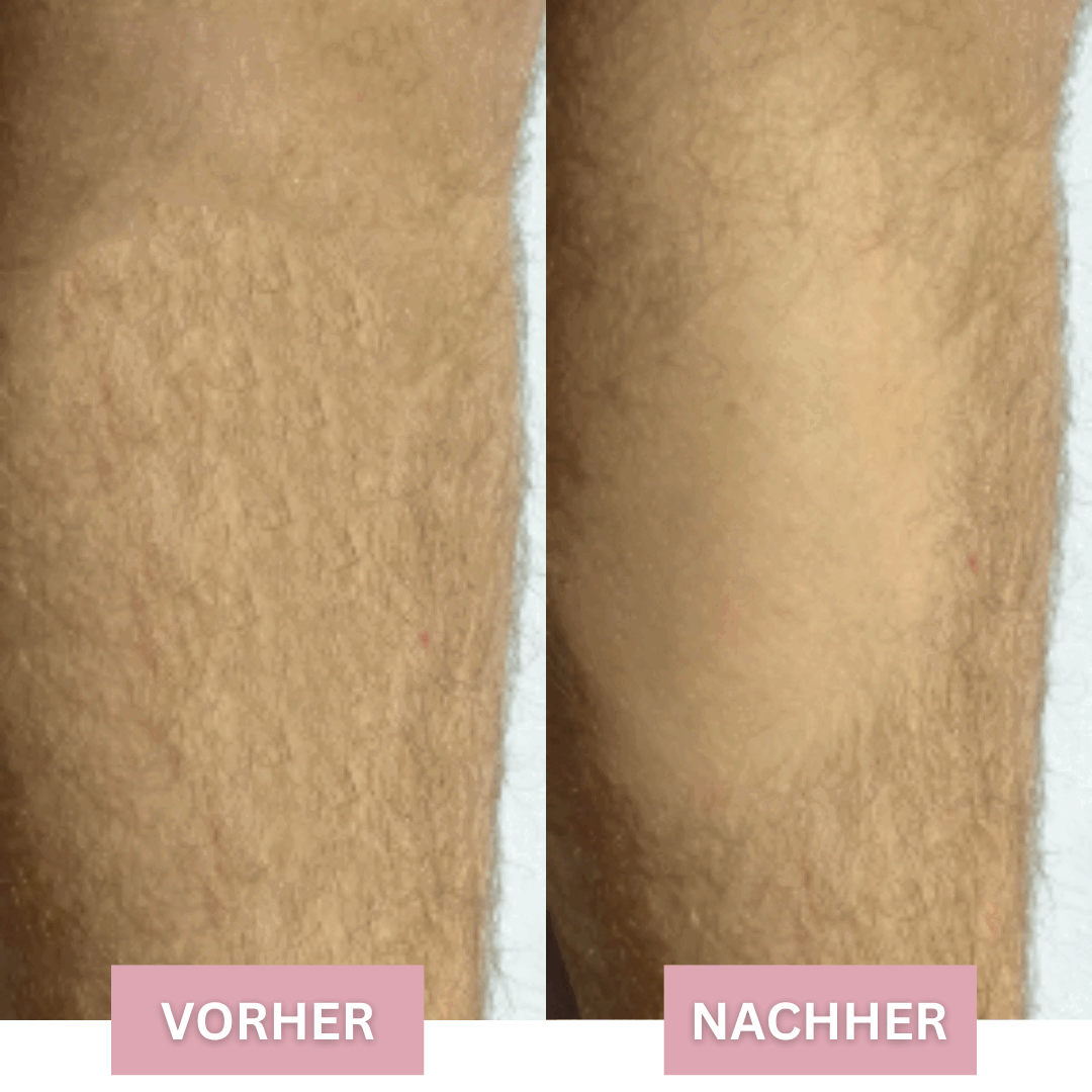Silken Skin™ Depilazione