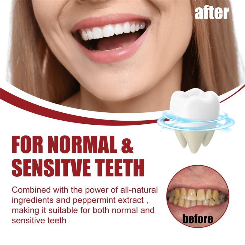 Vital Smile™ Super Probiotic-6 dentifricio con 6 probiotici