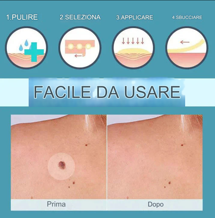 CoverLux™ Cerotti per la rimozione di macchie e nei della pelle