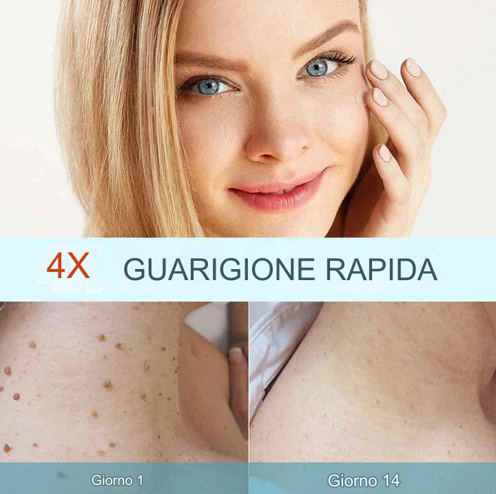 CoverLux™ Cerotti per la rimozione di macchie e nei della pelle