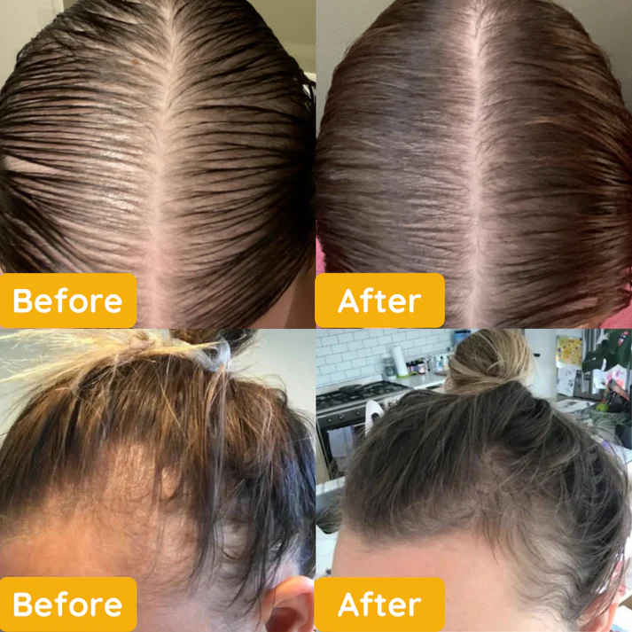 EELHOE Veghair™ Olio essenziale per la crescita dei capelli