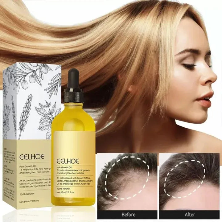 EELHOE Veghair™ Olio essenziale per la crescita dei capelli