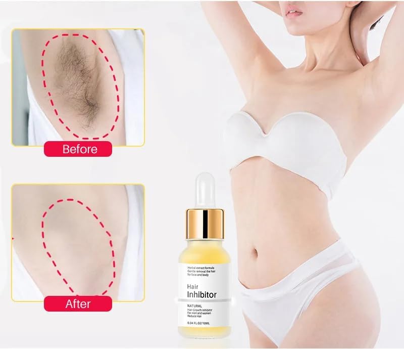 Seraphine™ Depilazione impeccabile del corpo